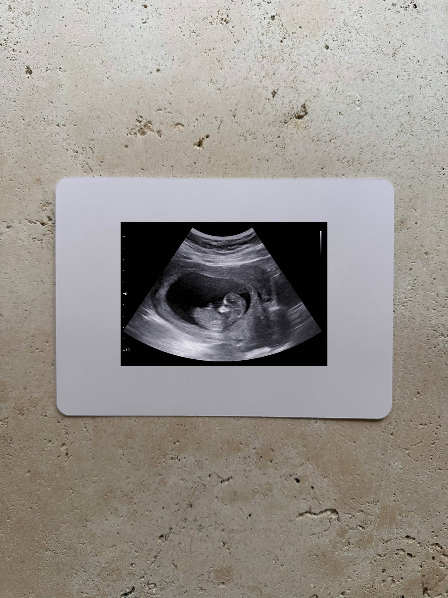 Baby On The Way Ultrasound Card