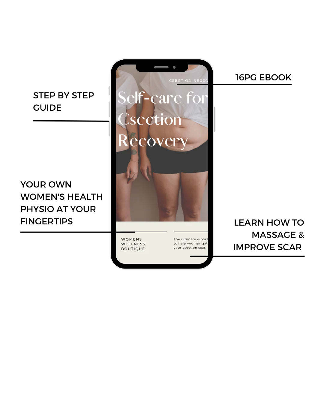 Csection Scar Recovery Kit