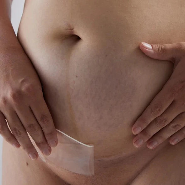 Bare Mum - Silicone Gel Scar Strips