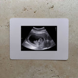 Baby On The Way Ultrasound Card